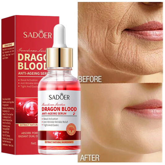 Royal Dragon Blood Serum Placenta Rejuvenation Moisturizing Smoothing Facial Firming Essence Improve Roughness Beauty Cosmetic